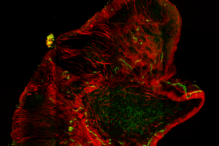 Biophotonics -  Cell imaging with ultrafast fiber lasers